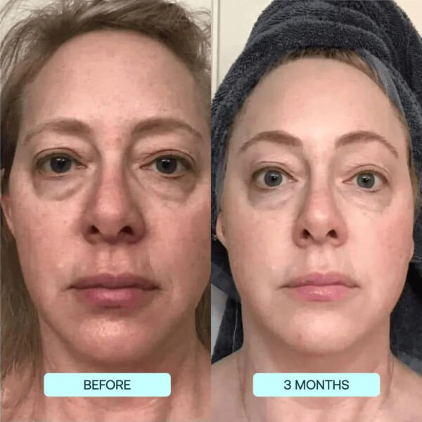 SkynPure™ - Pure Collagen Films - Emporium Shop